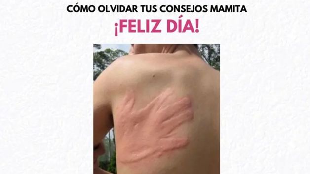 Imagen Placeholder