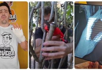 Pongámoslo a prueba: Jimmy Álvarez casi pierde un dedo tras probar un producto
