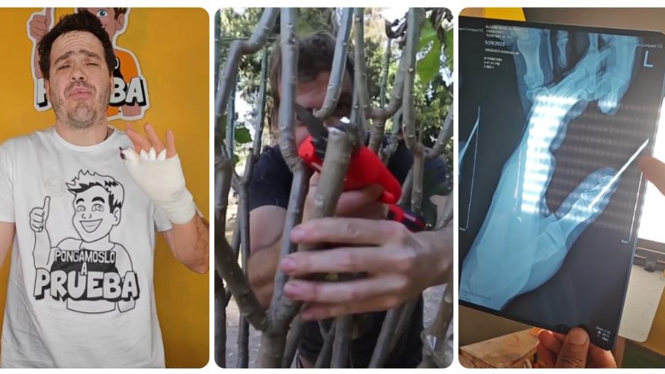 Pongámoslo a prueba: Jimmy Álvarez casi pierde un dedo tras probar un producto Pongámoslo a prueba: Jimmy Álvarez casi pierde un dedo tras probar un producto