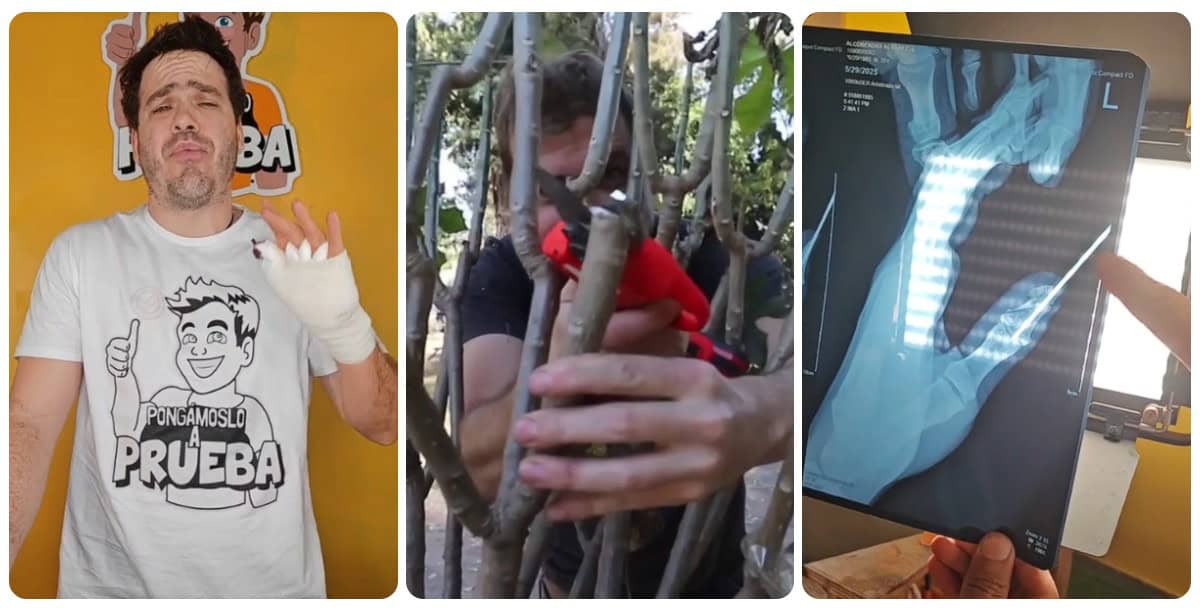 La herramienta le partió el hueso del pulgar. (FOTO: TikTok).