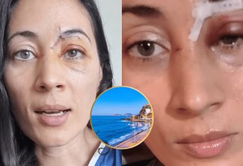Patín eléctrico embiste a mujer en la ciclovía del Malecón de Mazatlán; casi pierde un ojo