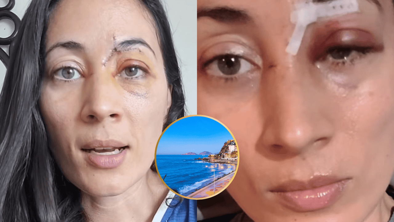 FOTO: Denuncia por accidente en malecón de Mazatlán.