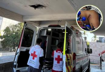Niño se electrocuta cuando jugaba en un árbol en Elota; Shriners lo ayudará con sus quemaduras