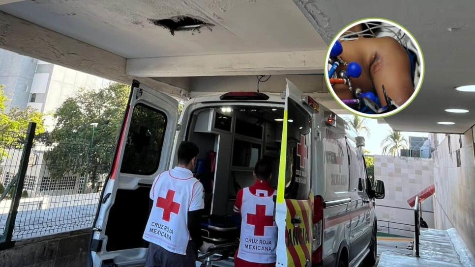 Niño se electrocuta cuando jugaba en un árbol en Elota; Shriners lo ayudará con sus quemaduras Niño se electrocuta cuando jugaba en un árbol en Elota; Shriners lo ayudará con sus quemaduras
