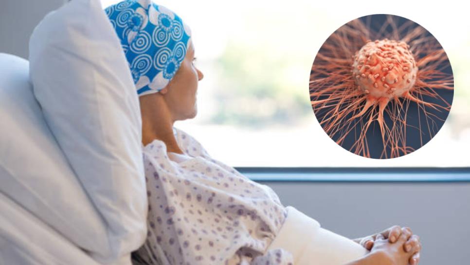 Estos son los tipos de cáncer más agresivos, dicho por un oncólogo Estos son los tipos de cáncer más agresivos, dicho por un oncólogo