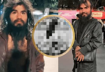 Así luce “La Diva Indigente” tras más de 50 días de rehabilitación | VIDEO