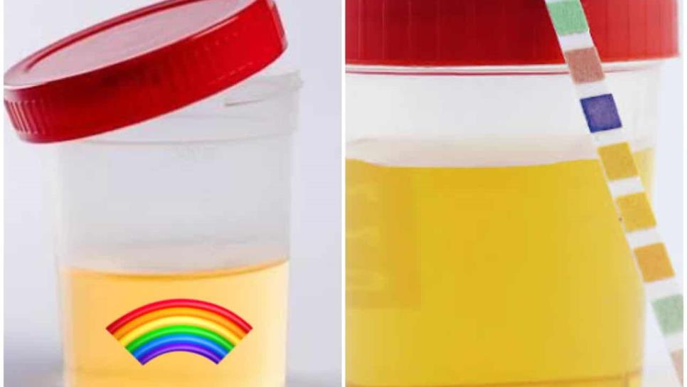El color de la orina dice cómo está tu salud ¿cuándo debes acudir al médico? El color de la orina dice cómo está tu salud ¿cuándo debes acudir al médico?