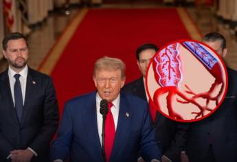 Insuficiencia venosa crónica: ¿Qué es la enfermedad que padece Donald Trump?