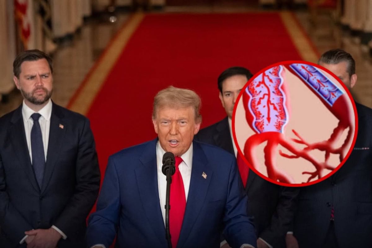 Insuficiencia venosa crónica: ¿Qué es la enfermedad que padece Donald Trump?