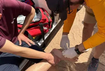 Heridas por mantarraya en la playa: qué hacer y qué nunca debes intentar