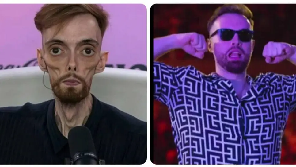 Ibai Llanos pide detener los memes que se burlan de su cambio físico