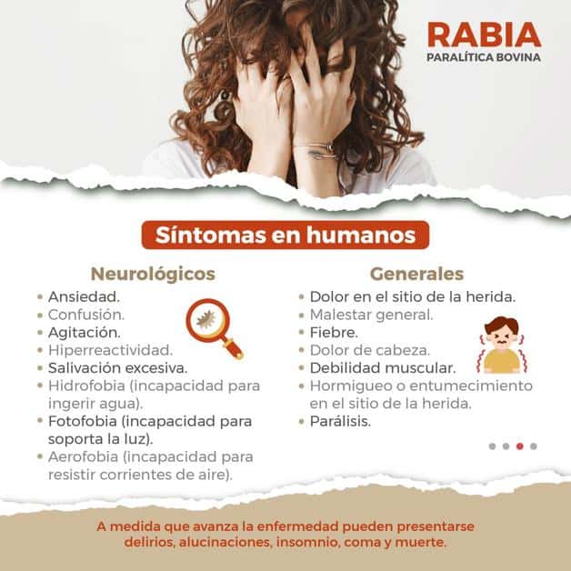 Imagen Placeholder Imagen Placeholder