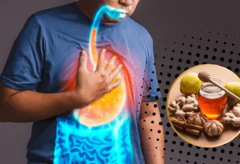 Remedio casero para acabar con las agruras al primer intento