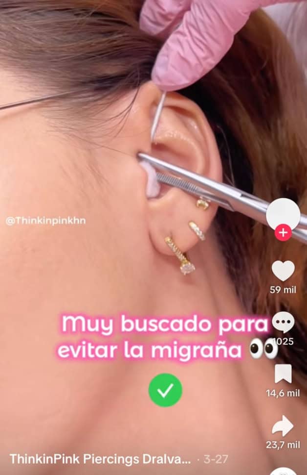Imagen Placeholder
