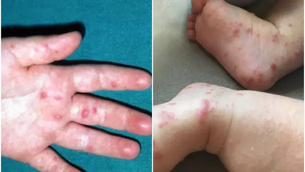 Nota Relacionada de México