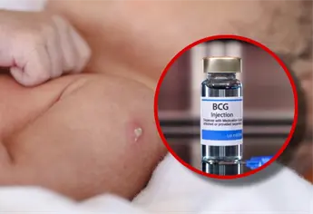 ¡Vacuna BCG ya estará disponible en Sinaloa! confirmó la Secretaría de Salud