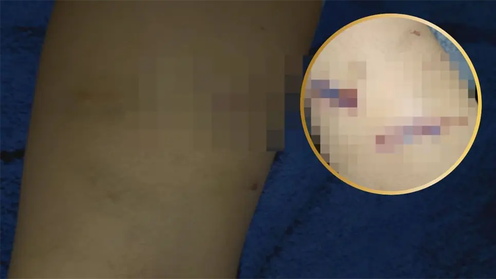 Perros agresivos atacan a niño en el ejido Primero de Mayo; vecinos piden intervención de autoridades