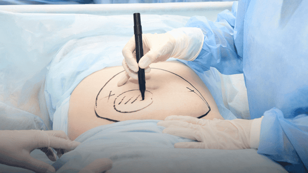 Imagen Placeholder Imagen Placeholder