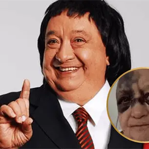 ¿Qué le pasó a Luis de Alba ´El Pirrurris´? El comediante reapareció irreconocible tras fuerte accidente ¿Qué le pasó a Luis de Alba ´El Pirrurris´? El comediante reapareció irreconocible tras fuerte accidente