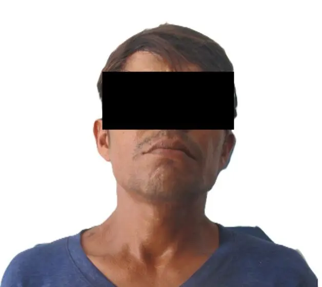 Imagen Placeholder