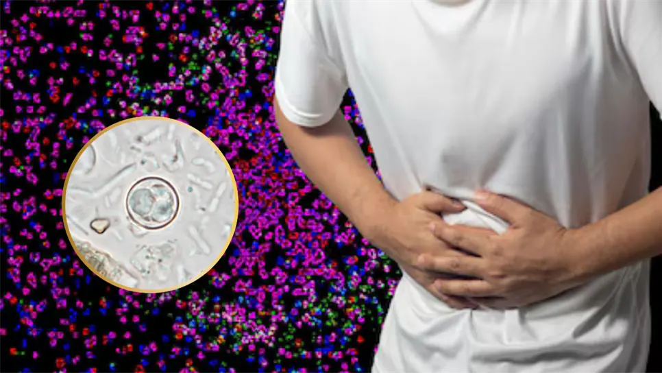 ¿Qué es la cyclospora? El parásito que provocó enfermedad intestinal en habitantes de 21 estados de EU